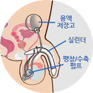 STEP 1 이미지